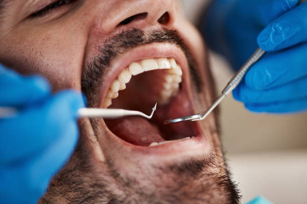 Best Emergency Treatment for Oral Infections in Brooklyn, WI